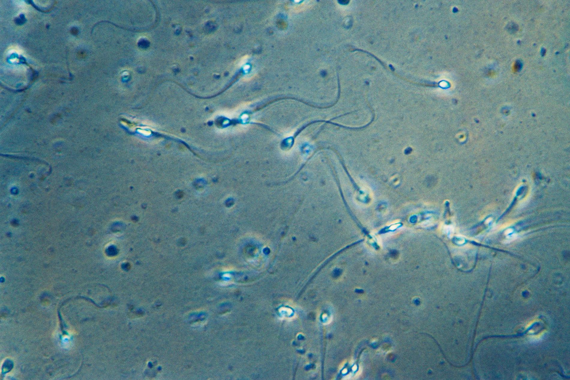 3d Illustration of a Damaged White Sperm Cells Stock Illustration ...